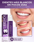 Blanqueador dental - dientes más blancos