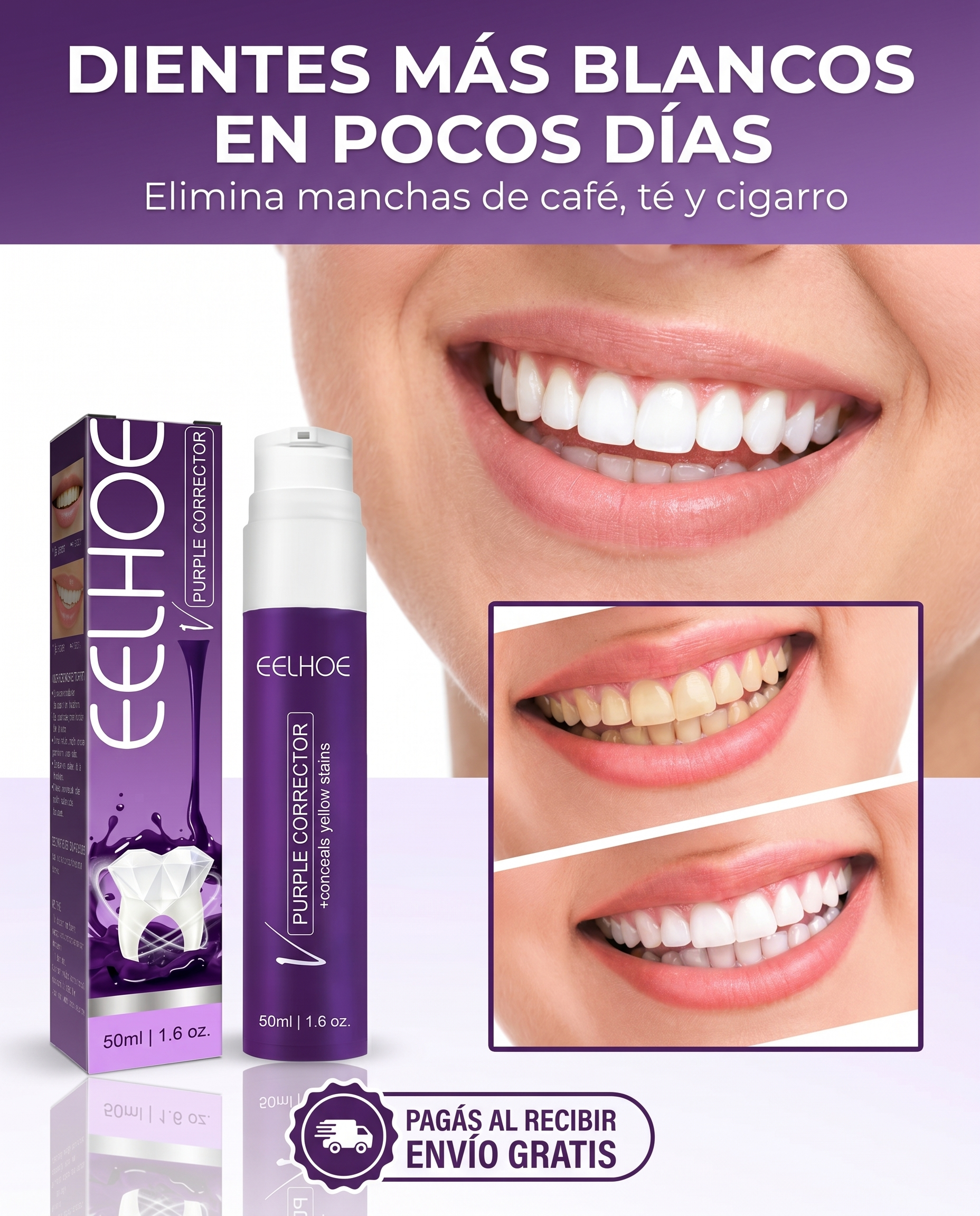 Blanqueador dental - dientes más blancos